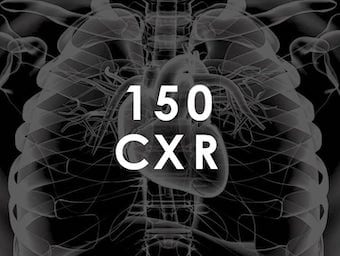 TOP-150-CXR-QUIZ-340 256
